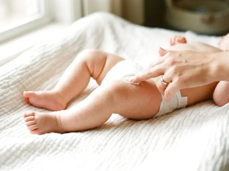 Pieluszkowe zapalenie skóry – objawy i leczenie